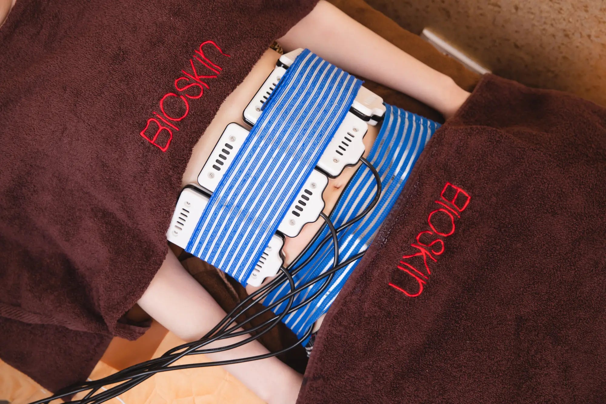 4-in-1 Lipofreeze Treatment