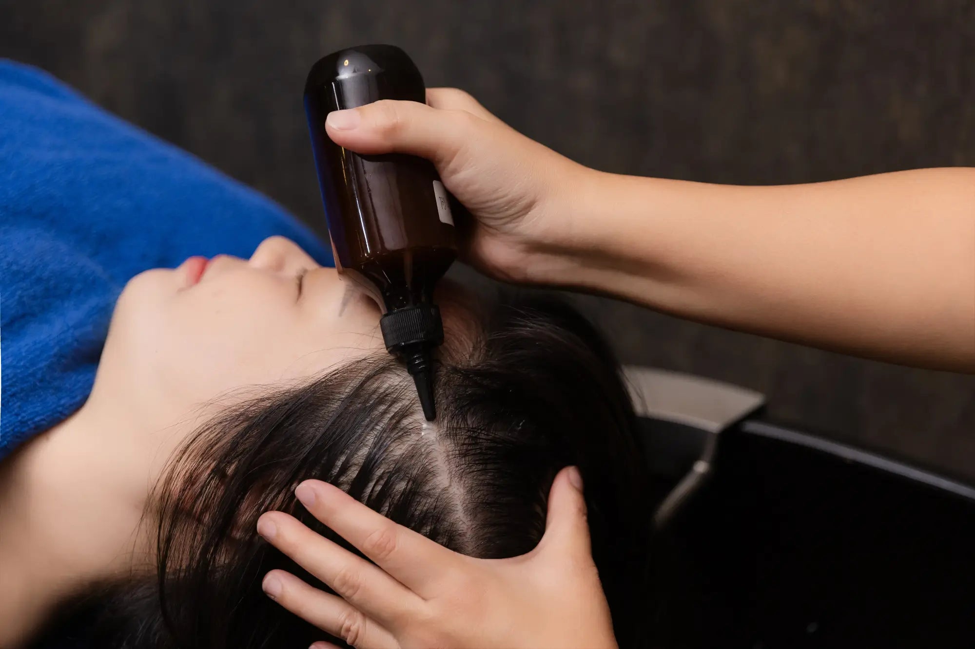 Stem Cell Hair Growth Treatment